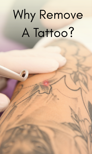 Reasons for tattoo removal