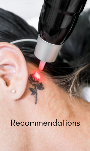 Tattoo Removal Recommendations