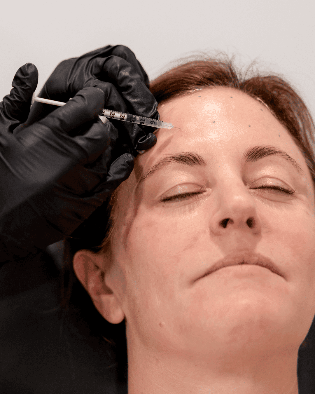 Botox 1 Botox 1