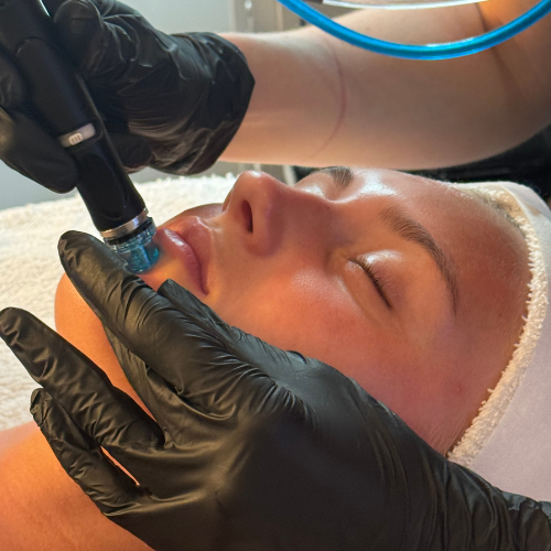 Enlarged Pores