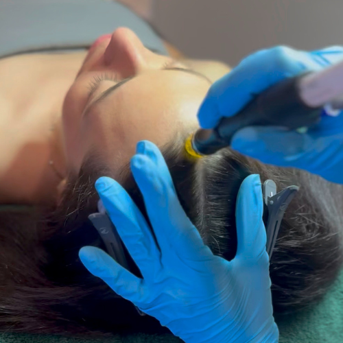 Thinning Hair
