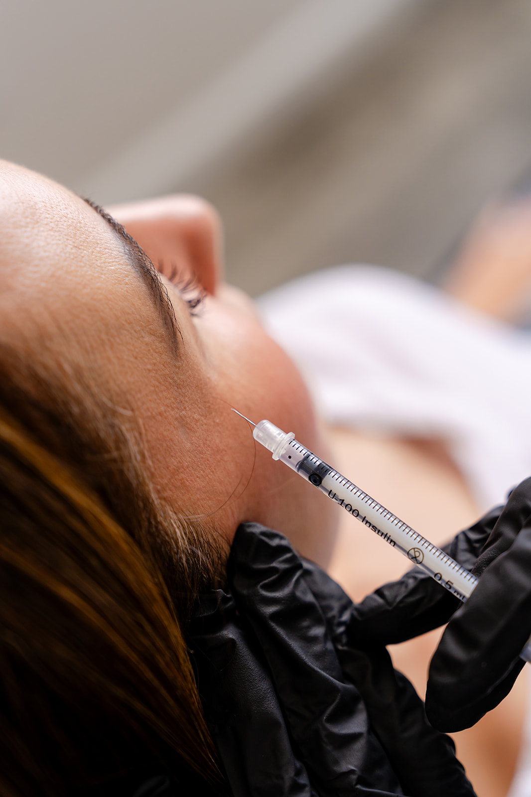 botox botox eyes