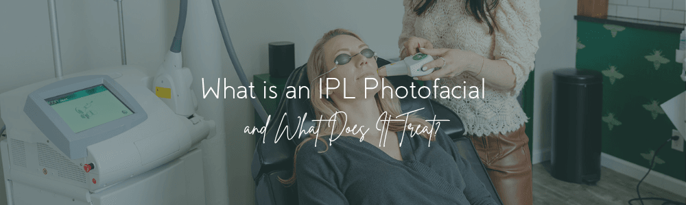 what is an IPL Photofacial
