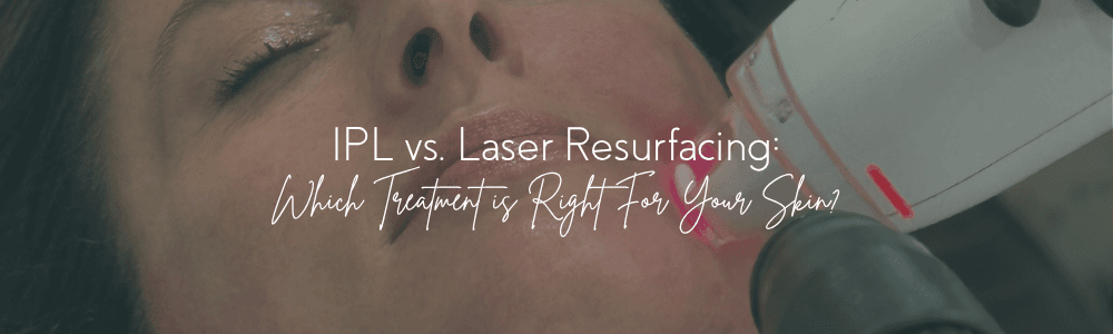 IPL vs. Laser Resurfacing